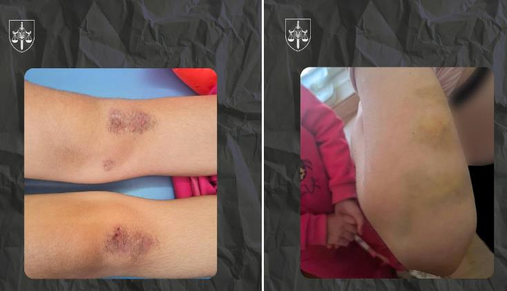 На Полтавщині опікунка катувала молодших сестер